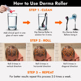 Opecia Derma Roller 0.5MM For Bald Patches, Hair Regrowth & Scalp Activation | With 540 Titanium Alloy Needles | Safe & Effective to Use