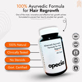 Male Pattern Baldness Hair Loss Treatment | Best Natural Ayurvedic Solutions for Baldness Alopecia