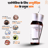 एलोपेसिया का आयुर्वेदिक इलाज - प्राकृतिक रूप से बालों को पुनः उगाएँ