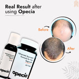 Chemotherapy Hair Loss Treatment | Best Natural Ayurvedic Solution for Regrowth & Scalp Healing