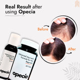 Trichotillomania Hair Loss Treatment | Best Natural Ayurvedic Solution for Trichotillomania Alopecia