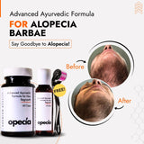 Alopecia Barbae Treatment | Natural Ayurvedic Solution for Beard Patch