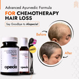 Chemotherapy Hair Loss Treatment | Best Natural Ayurvedic Solution for Regrowth & Scalp Healing