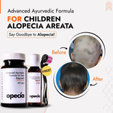 Best Ayurvedic Treatment for Children Alopecia Areata