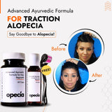 Traction Alopecia Hair Loss Treatment | Best Natural Solution for Hair Regrowth & Scalp Repair