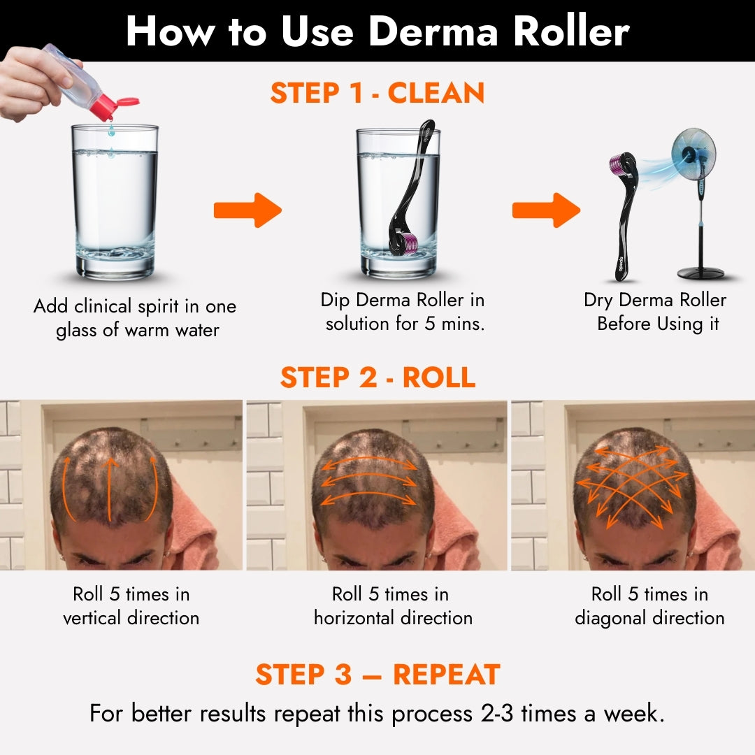 Opecia Derma Roller 0.5MM For Bald Patches, Hair Regrowth & Scalp Activation | With 540 Titanium Alloy Needles | Safe & Effective to Use