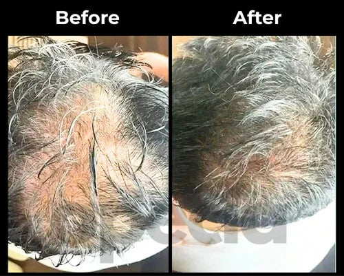 Before and After results
