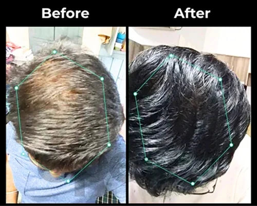 Before and After results
