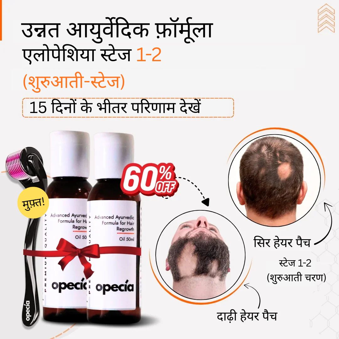 एलोपेसिया का आयुर्वेदिक इलाज - प्राकृतिक रूप से बालों को पुनः उगाएँ