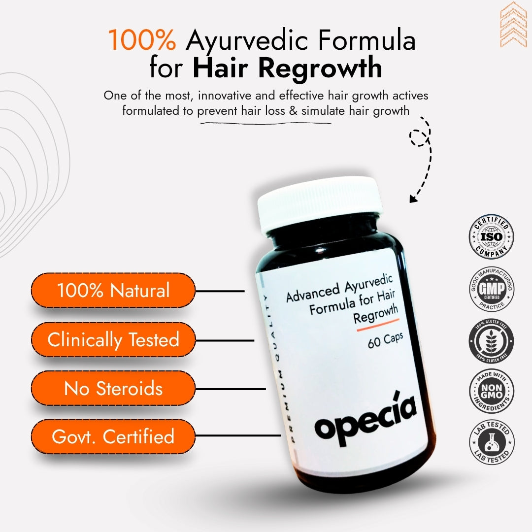 Best Ayurvedic Treatment for Alopecia Areata (Oil + Capsules)