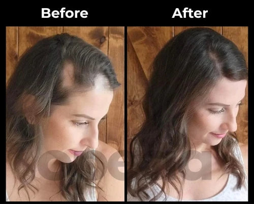 Before and After results