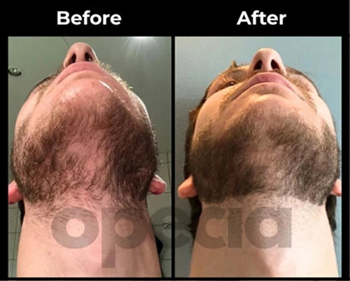 Before and After results