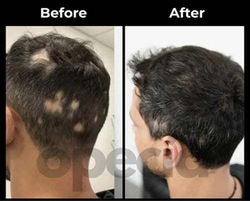 Before and After results