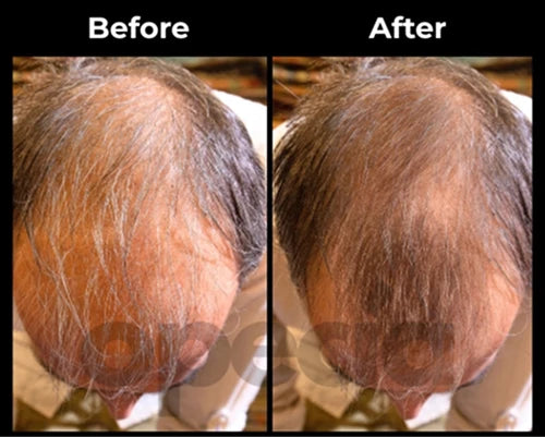 Before and After results