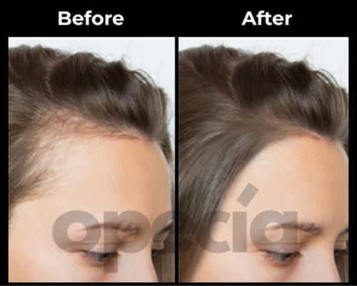Before and After results