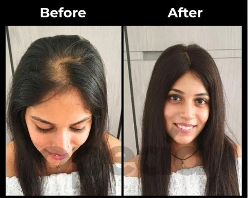 Before and After results
