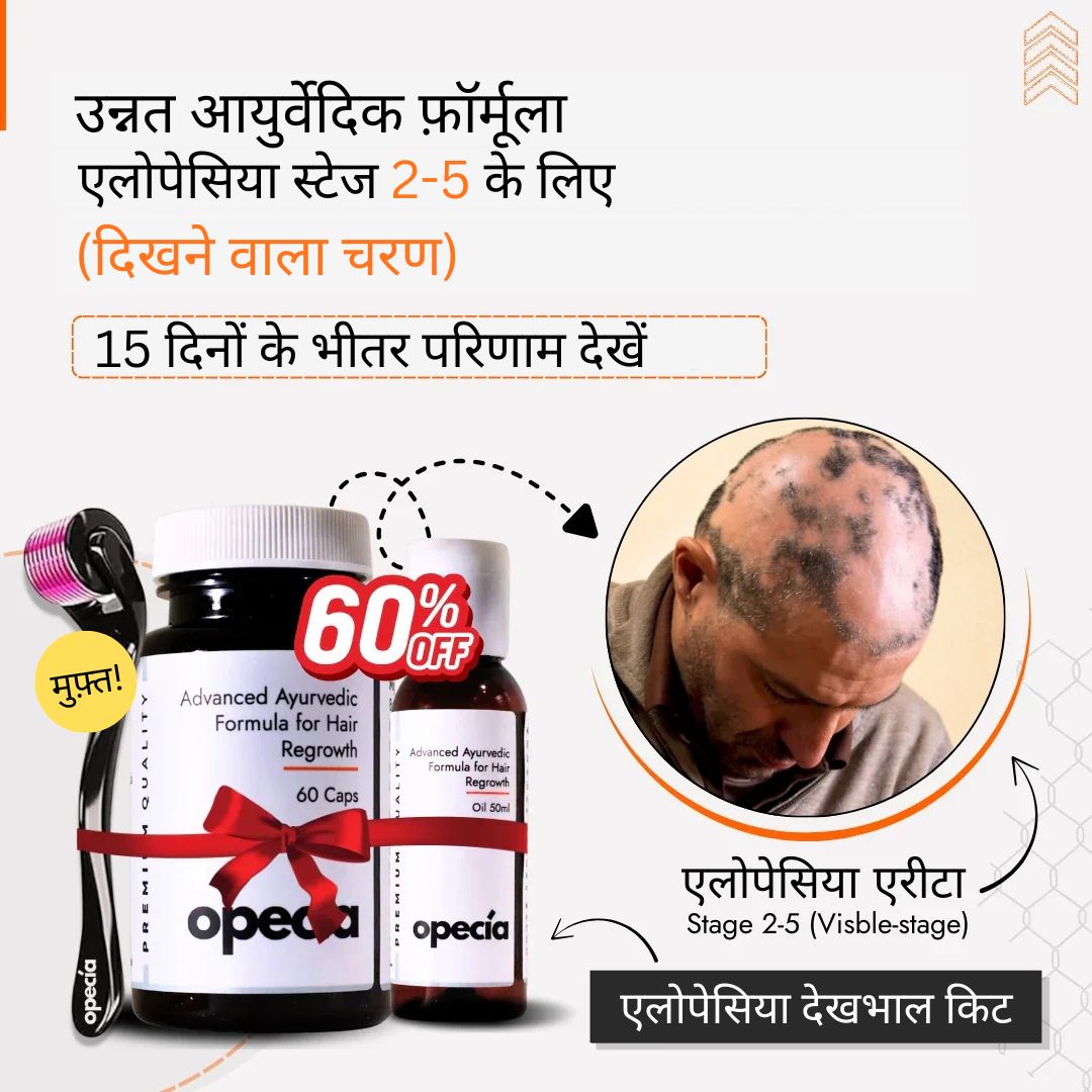 एलोपेसिया का आयुर्वेदिक इलाज - प्राकृतिक रूप से बालों को पुनः उगाएँ