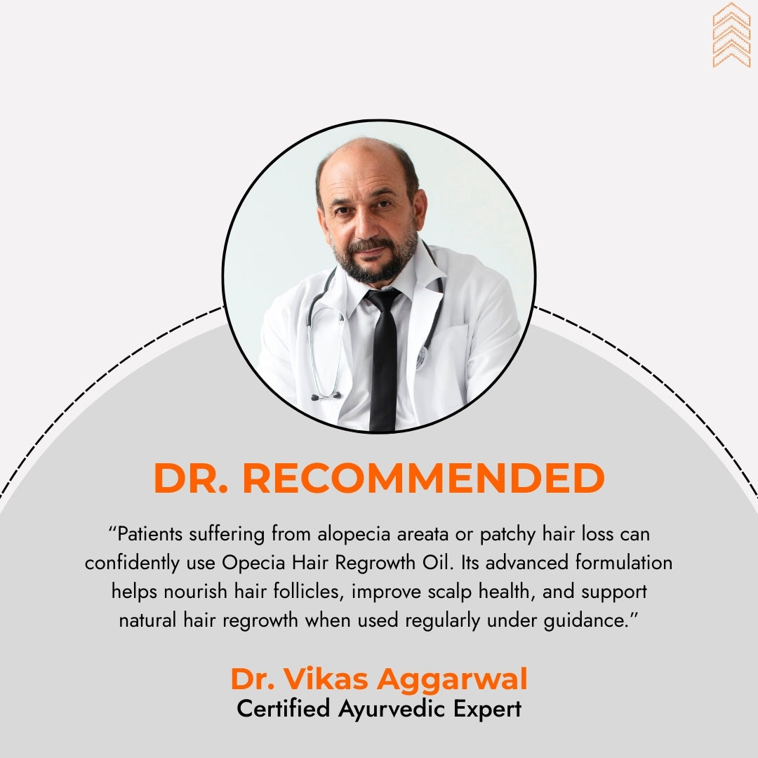 Advanced Formula For Alopecia Treatment - (100% Result)