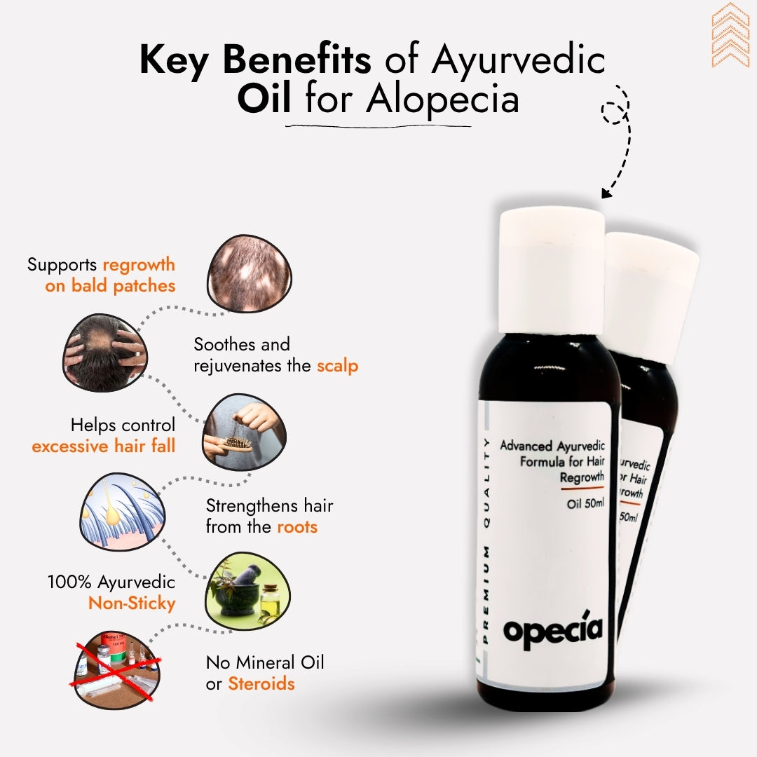 Best Ayurvedic Treatment for Alopecia Areata (Oil + Capsules)