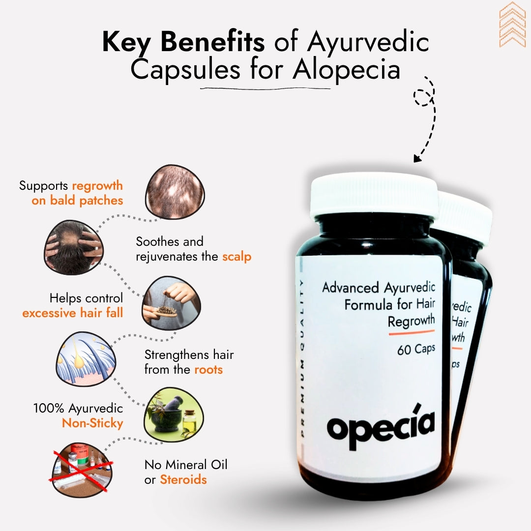 Best Ayurvedic Treatment for Alopecia Areata (Oil + Capsules)