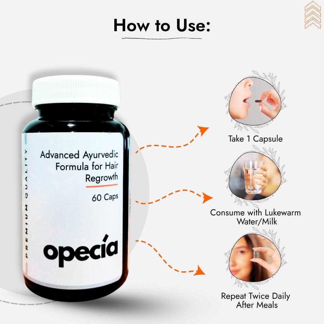 Best Ayurvedic Treatment for Alopecia Areata (Oil + Capsules)