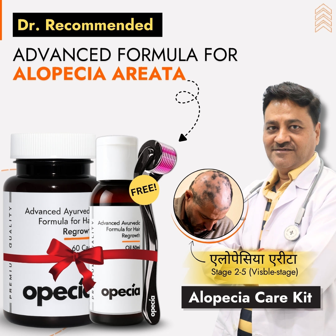 Advanced Formula For Alopecia Treatment - (100% Result)