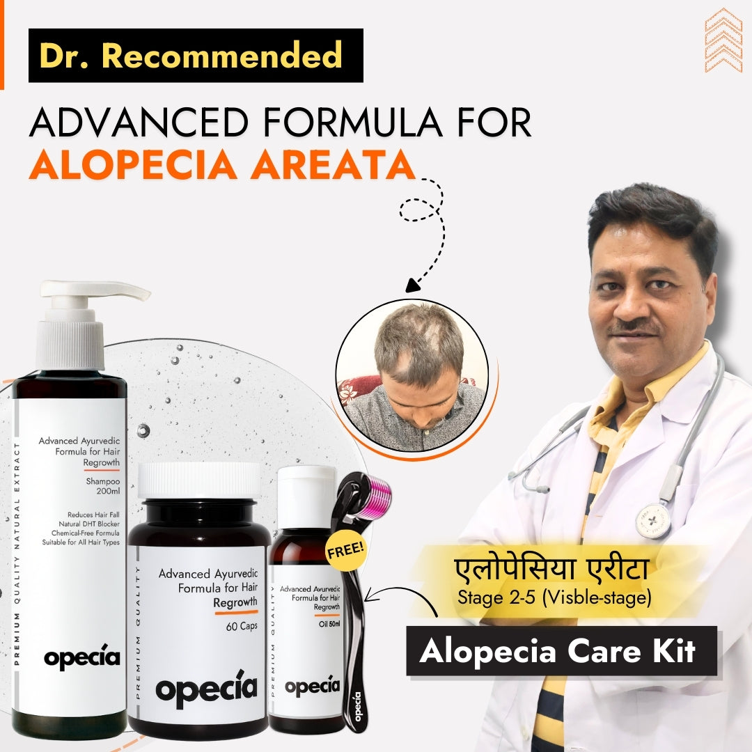 Advanced Formula For Alopecia Treatment - (100% Result)