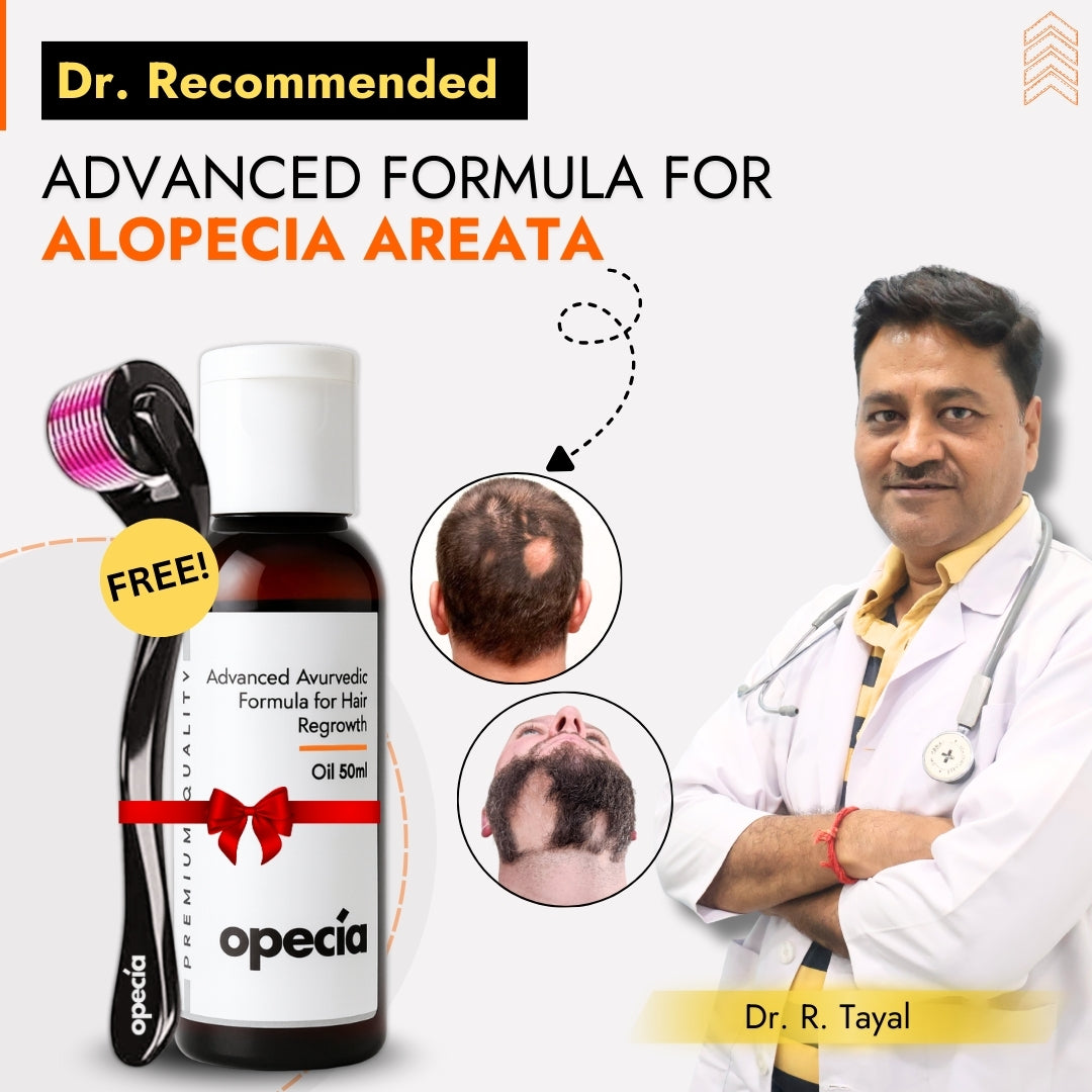 Advanced Formula For Alopecia Treatment - (100% Result)