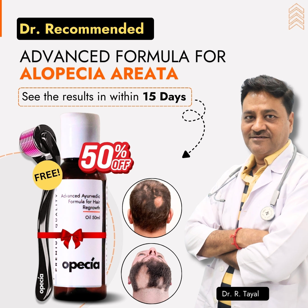 Alopecia Hair Patch Solution for Bald Patches - 100% Natural Treatment