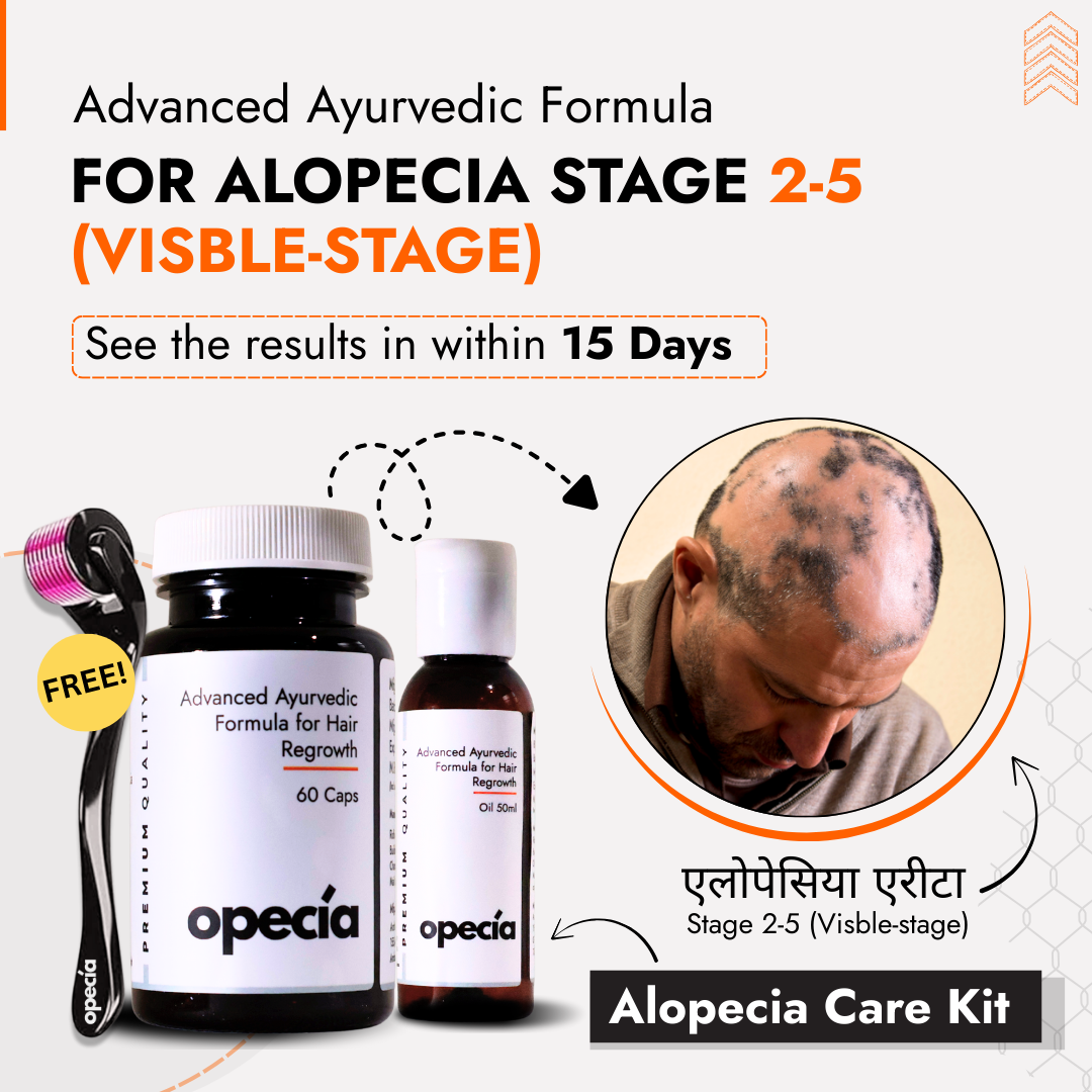 Alopecia Hair Patch Solution for Bald Patches - 100% Natural Treatment