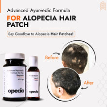 Advanced Alopecia Treatment Kit
