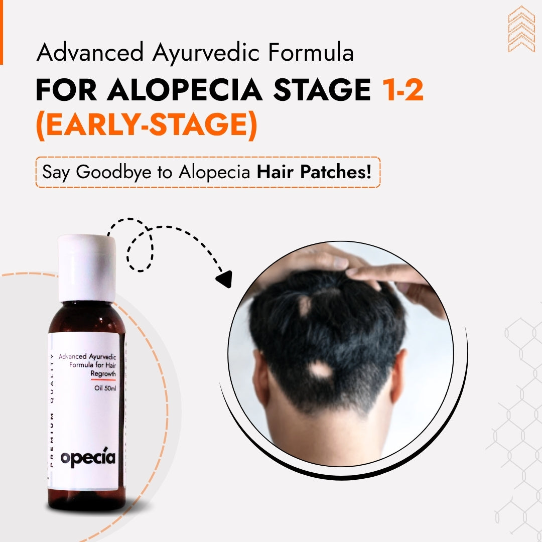 Alopecia Hair Patch Solution for Bald Patches - 100% Natural Treatment