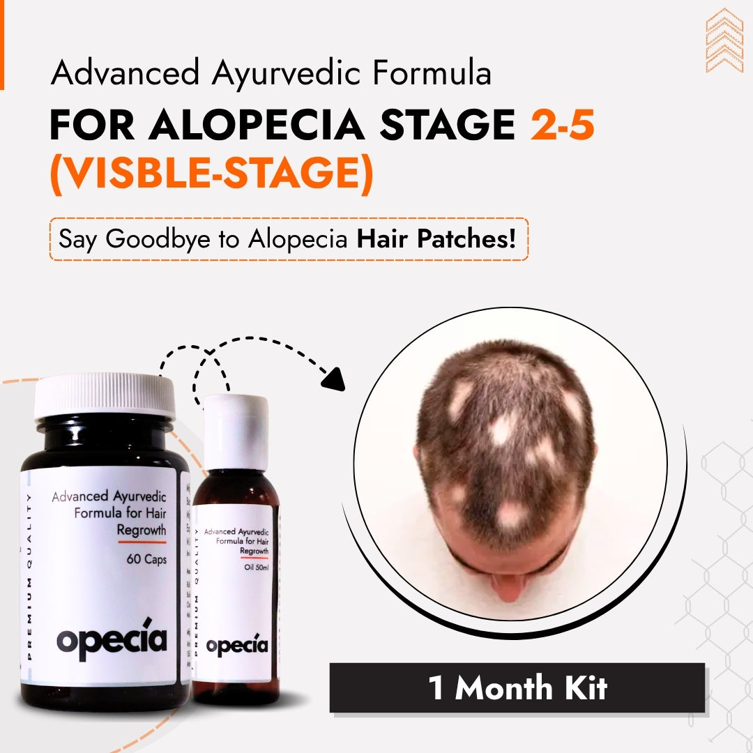 Alopecia Areata Hair Patch Solution for Bald Patches - 100% Natural Oil