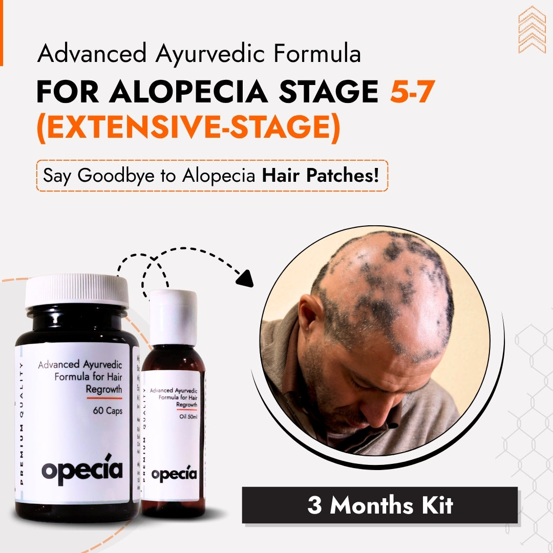 Alopecia Areata Hair Patch Solution for Bald Patches - 100% Natural Oil