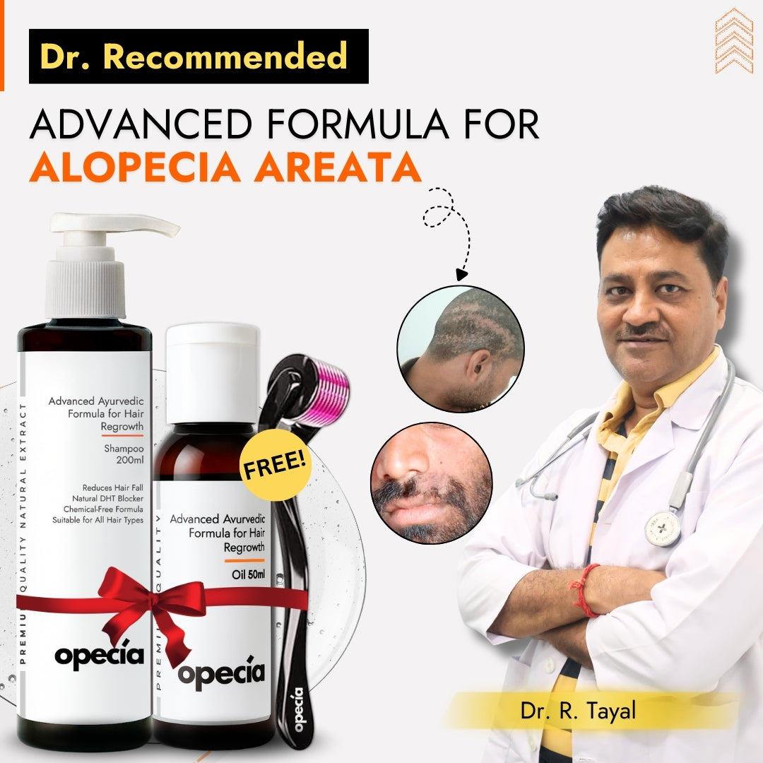 Advanced Formula For Alopecia Treatment - (100% Result)