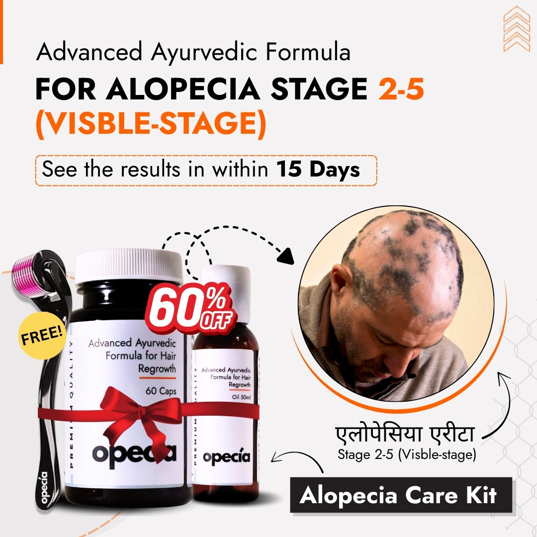 Alopecia Hair Patch Solution for Bald Patches - 100% Natural Treatment