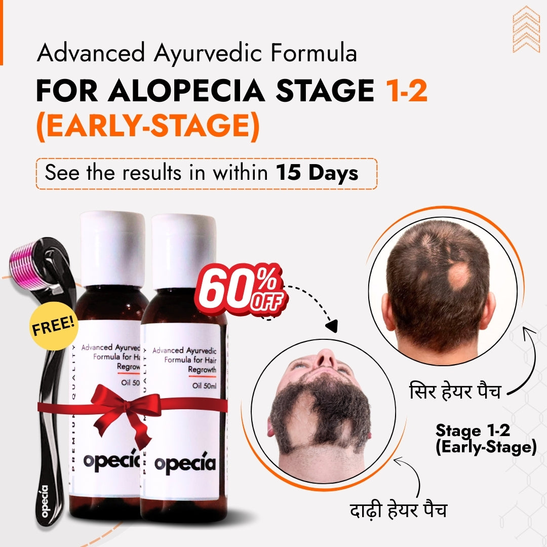 Alopecia Hair Patch Solution for Bald Patches - 100% Natural Treatment
