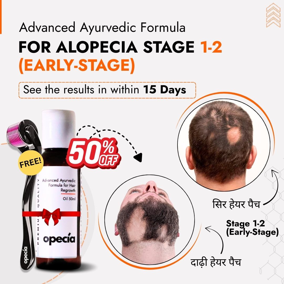 Alopecia Hair Patch Solution for Bald Patches - 100% Natural Treatment