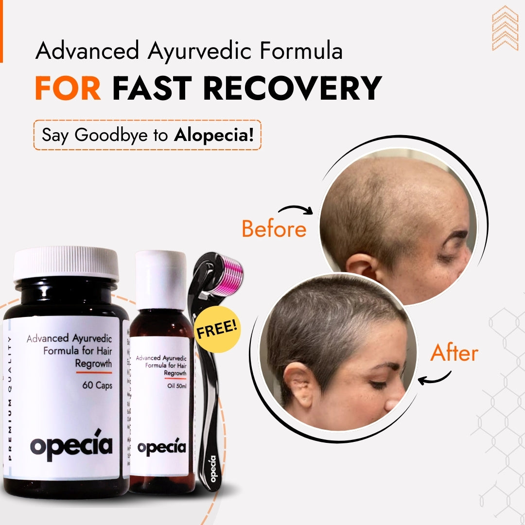 Alopecia Hair Patch Solution | Alopecia Areata Treatment Medicine | 100% Pure Extract with No Side Effects