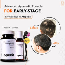 Advanced Alopecia Treatment Kit