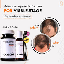 Advanced Alopecia Treatment Kit