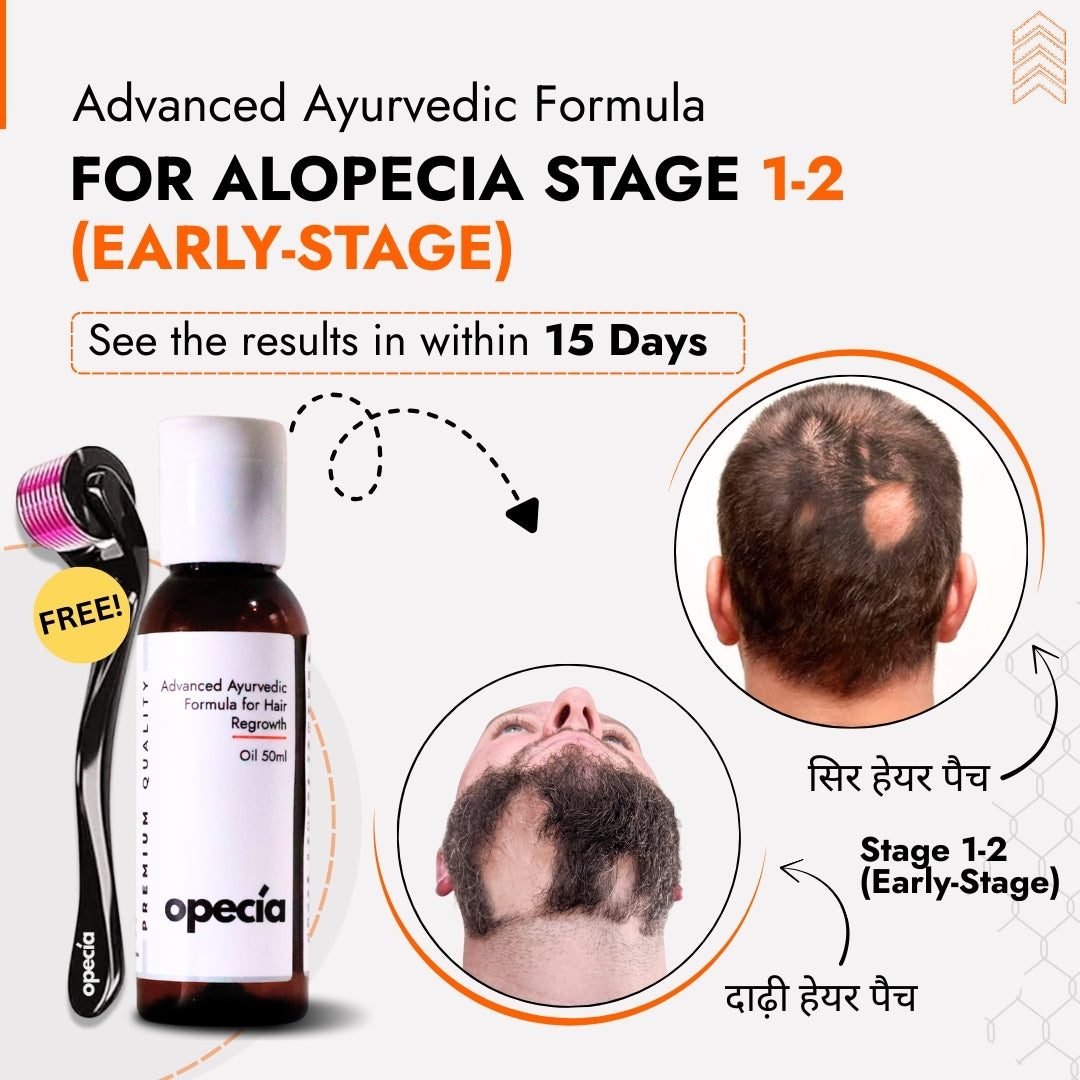 Alopecia Hair Patch Solution for Bald Patches - 100% Natural Treatment