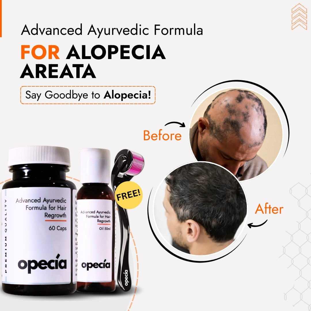 Alopecia Hair Patch Solution for Bald Patches - 100% Natural Treatment