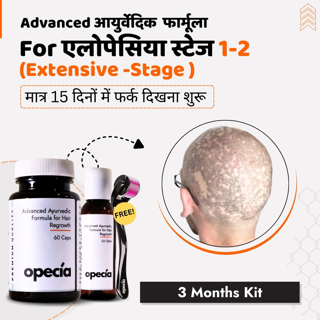 एलोपेसिया का आयुर्वेदिक इलाज - प्राकृतिक रूप से बालों को पुनः उगाएँ