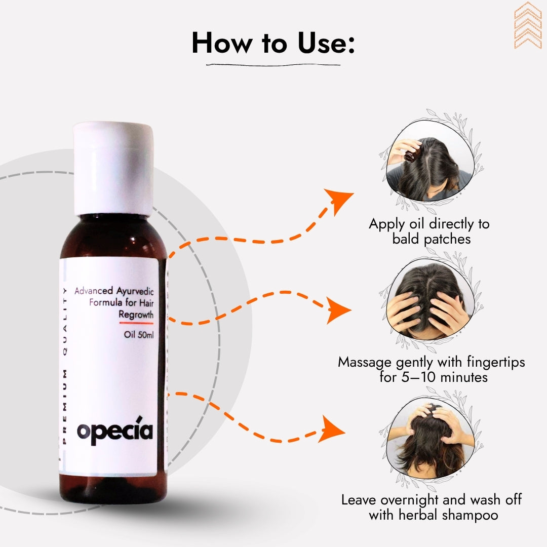 Alopecia Hair Patch Solution for Bald Patches - 100% Natural Treatment